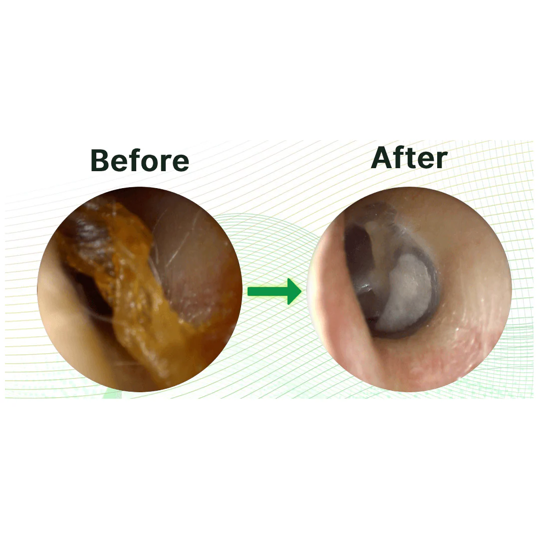 Hearix™ - Visual Ear Cleaner