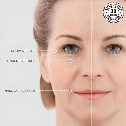 HydraLift™ - Eye Glow Patches